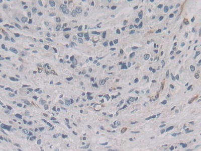 Monoclonal Antibody to Vascular Endothelial Growth Factor 121 (VEGF121)