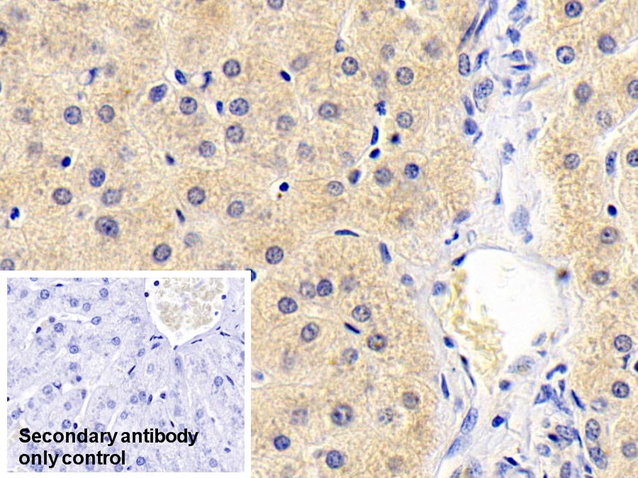 Monoclonal Antibody to Antithrombin (AT)