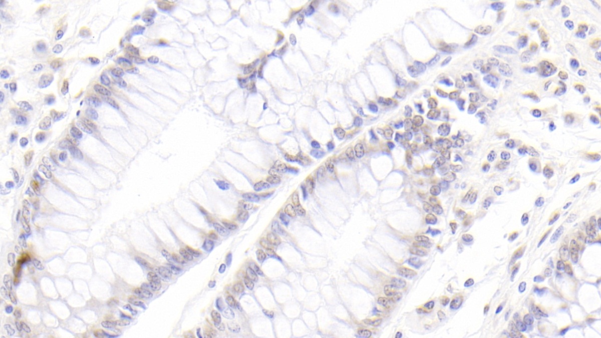 Monoclonal Antibody to Caudal Type Homeobox 2 (CDX2)