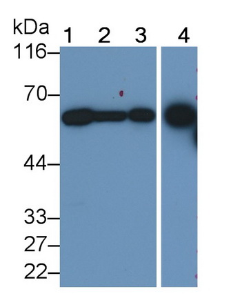 Monoclonal Antibody to Dipeptidase 1, Renal (DPEP1)