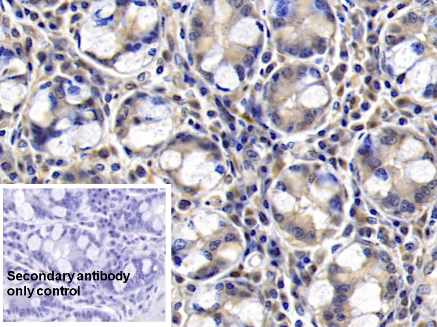 Monoclonal Antibody to Fibroblast Activation Protein Alpha (FAPa)