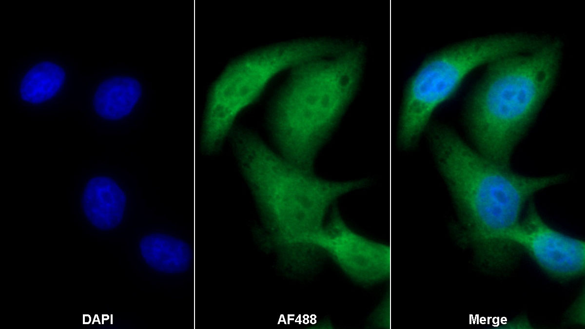 Monoclonal Antibody to Fibroblast Growth Factor 21 (FGF21)