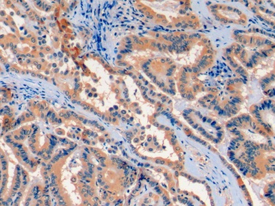 Monoclonal Antibody to Fibroblast Growth Factor 21 (FGF21)