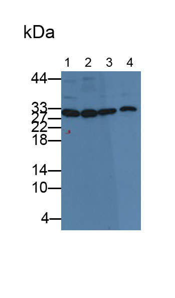 Monoclonal Antibody to Carbonic Anhydrase III, Muscle Specific (CA3)