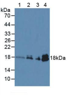 Monoclonal Antibody to Troponin C Type 1, Slow (TNNC1)
