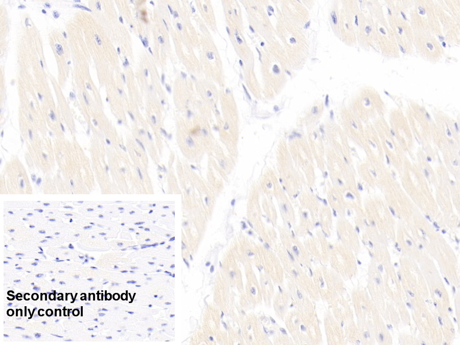Monoclonal Antibody to Troponin T Type 2, Cardiac (TNNT2)