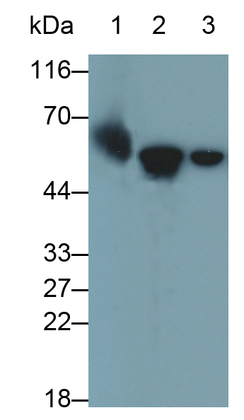 Monoclonal Antibody to Keratin 6A (KRT6A)