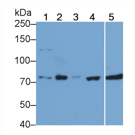 Monoclonal Antibody to Receptor Interacting Serine Threonine Kinase 1 (RIPK1)