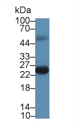 Monoclonal Antibody to FK506 Binding Protein 7 (FKBP7)