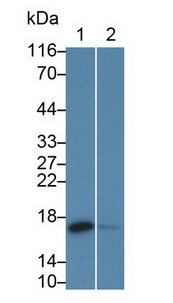 Monoclonal Antibody to Cellular Retinoic Acid Binding Protein 2 (CRABP2)
