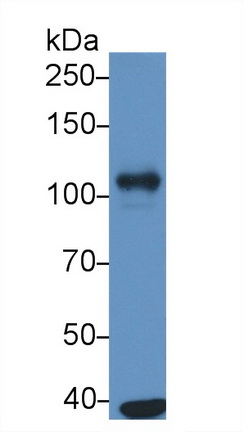 Monoclonal Antibody to ATPase, Na+/K+ Transporting Alpha 1 Polypeptide (ATP1a1)