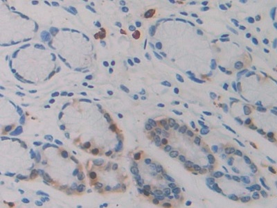 Monoclonal Antibody to Isocitrate Dehydrogenase 1, Soluble (IDH1)
