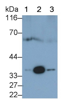 Monoclonal Antibody to Catechol-O-Methyltransferase (COMT)