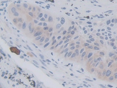 Monoclonal Antibody to V-Ral Simian Leukemia Viral Oncogene Homolog A (RALA)