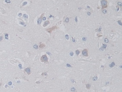 Monoclonal Antibody to V-Ral Simian Leukemia Viral Oncogene Homolog A (RALA)