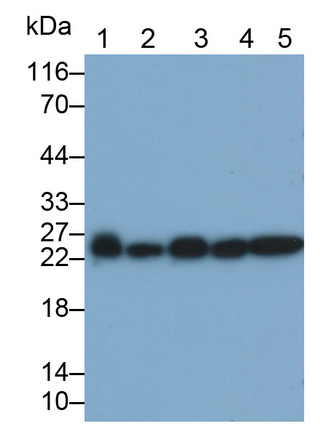 Monoclonal Antibody to Proteasome 26S Subunit, Non ATPase 10 (PSMD10)