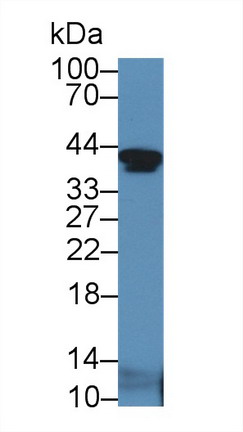 Polyclonal Antibody to Insulin Like Growth Factor Binding Protein 2 (IGFBP2)