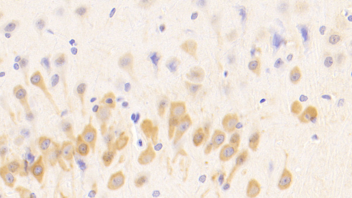 Polyclonal Antibody to Meningioma Expressed Antigen 5 (MGEA5)