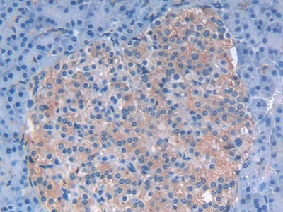 Polyclonal Antibody to Leukemia Inhibitory Factor (LIF)