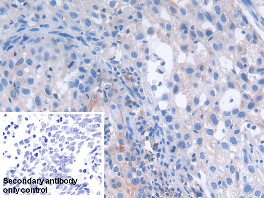 Polyclonal Antibody to Leukemia Inhibitory Factor (LIF)