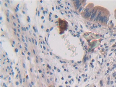 Polyclonal Antibody to Colony Stimulating Factor 1, Macrophage (MCSF)