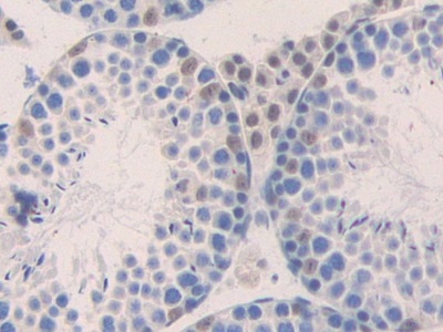 Polyclonal Antibody to Macrophage Inflammatory Protein 1 Beta (MIP1b)
