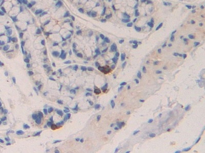 Polyclonal Antibody to Macrophage Inflammatory Protein 1 Beta (MIP1b)