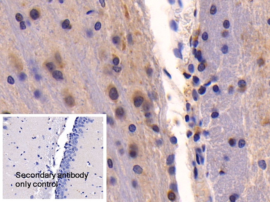Polyclonal Antibody to Nerve Growth Factor (NGF)