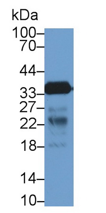 Polyclonal Antibody to Cluster Of Differentiation 40 Ligand (CD40L)