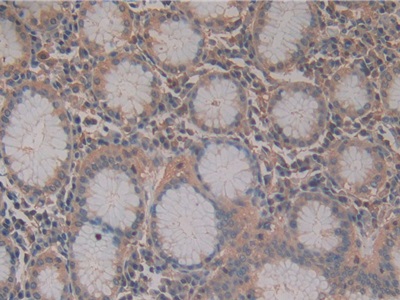 Polyclonal Antibody to Stem Cell Factor (SCF)
