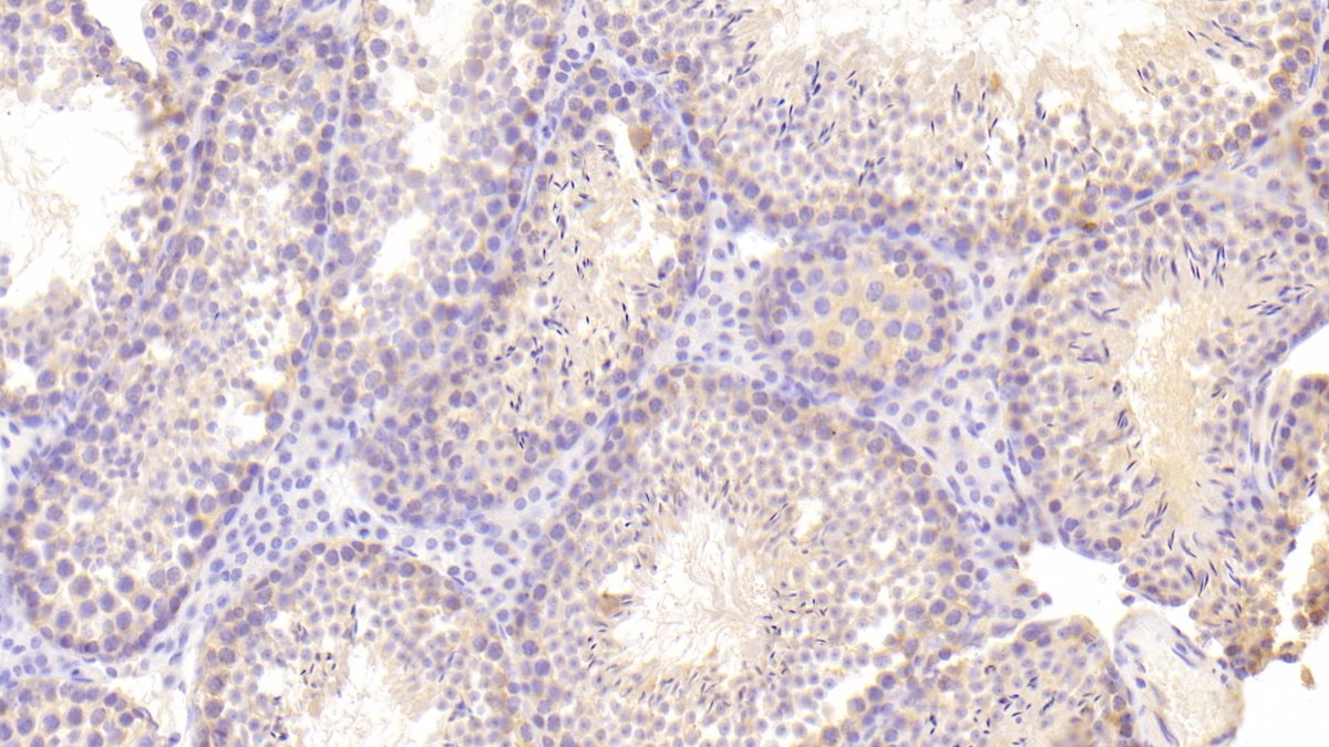 Polyclonal Antibody to Stem Cell Factor Receptor (SCFR)