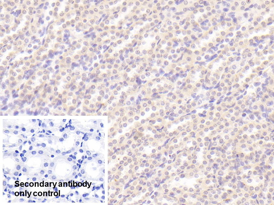 Polyclonal Antibody to Tissue Inhibitors Of Metalloproteinase 3 (TIMP3)