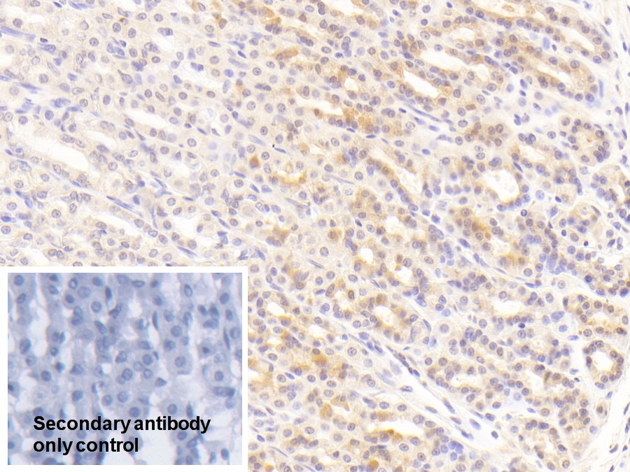 Polyclonal Antibody to Tissue Inhibitors Of Metalloproteinase 3 (TIMP3)