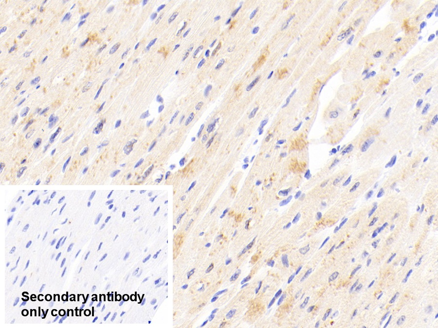 Polyclonal Antibody to Tissue Inhibitors Of Metalloproteinase 4 (TIMP4)