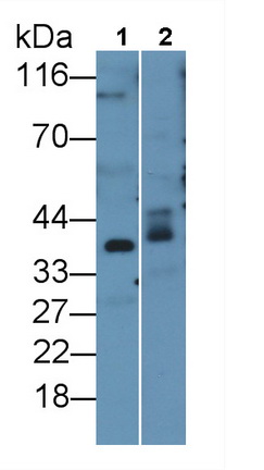 Polyclonal Antibody to Adiponectin Receptor 2 (ADIPOR2)