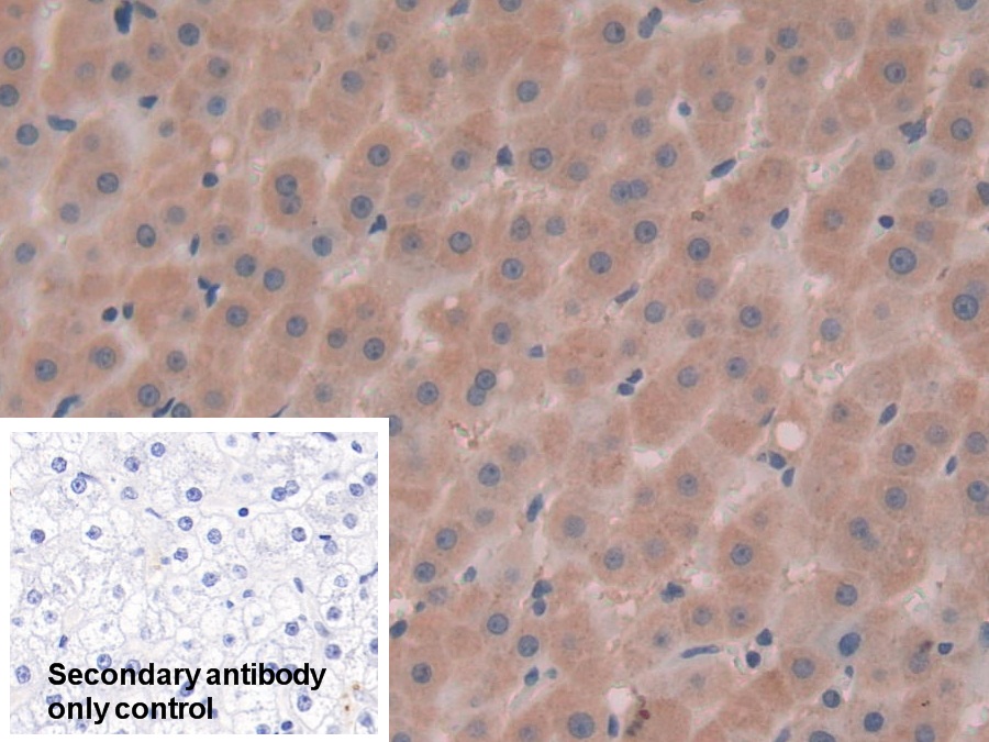 Polyclonal Antibody to Alpha-Fetoprotein (AFP)