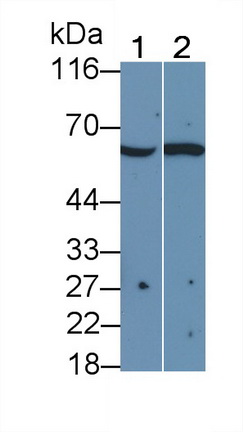 Polyclonal Antibody to Interleukin 2 Receptor Beta (IL2Rb)