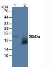 Polyclonal Antibody to WAP Four Disulfide Core Domain Protein 2 (WFDC2)