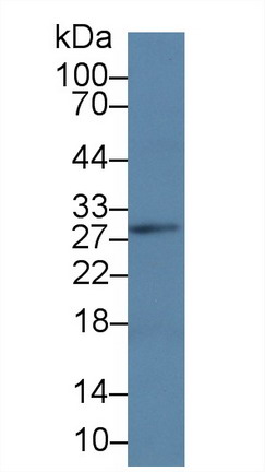 Polyclonal Antibody to Linker For Activation Of T-Cell (LAT)