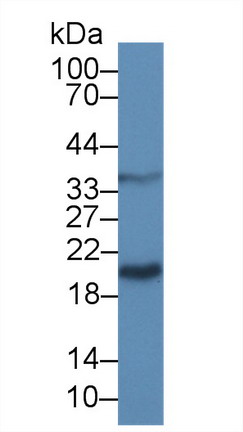 Polyclonal Antibody to Galectin 9 (GAL9)