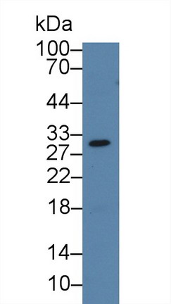 Polyclonal Antibody to Galectin 12 (GAL12)