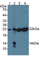 Polyclonal Antibody to Proteasome subunit beta type-9 (PSMB9)