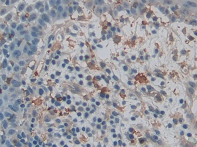 Polyclonal Antibody to Gelsolin (GSN)