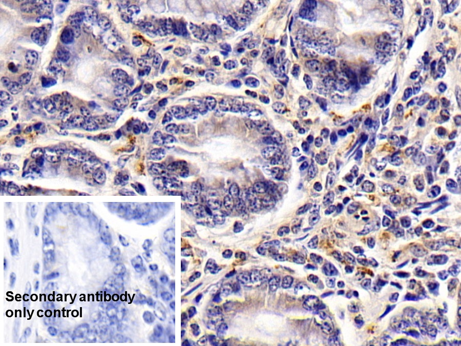 Polyclonal Antibody to Vasoactive Intestinal Peptide (VIP)