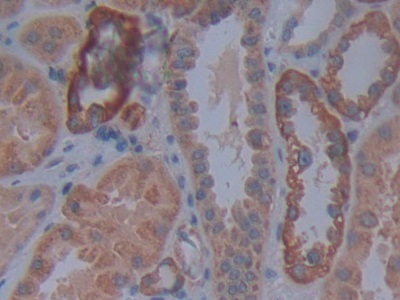 Polyclonal Antibody to Cadherin, Retinal (RCAD)