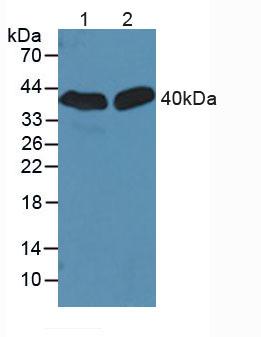 Polyclonal Antibody to Sirtuin 2 (SIRT2)