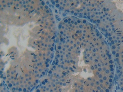 Polyclonal Antibody to Osteocalcin (OC)