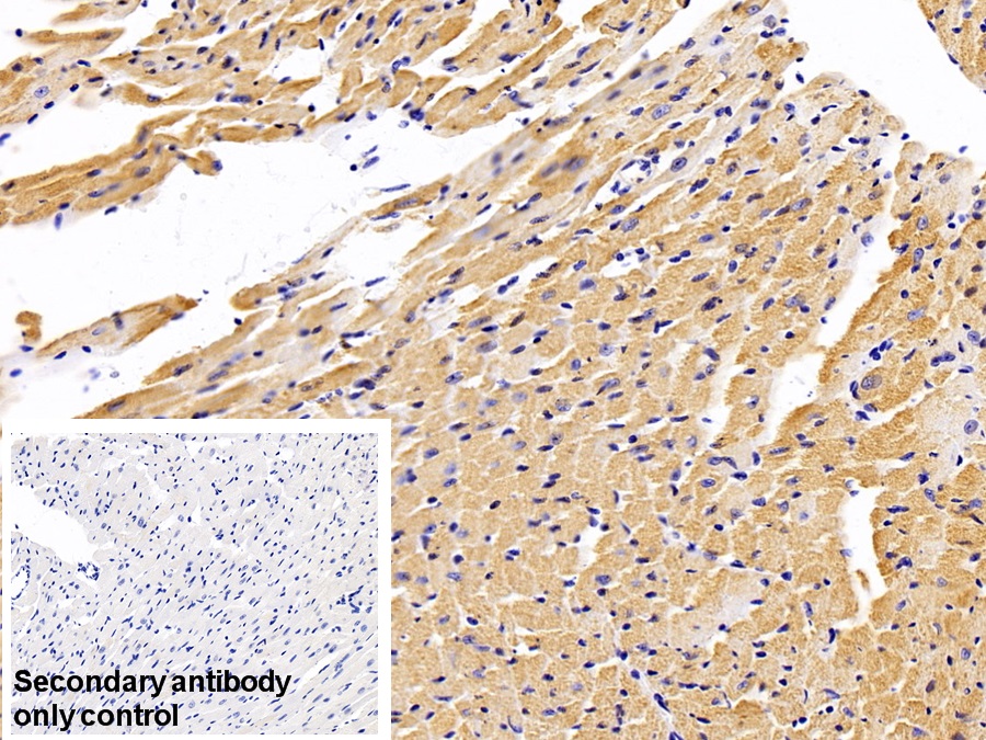 Polyclonal Antibody to Cardiac Troponin I (cTnI)