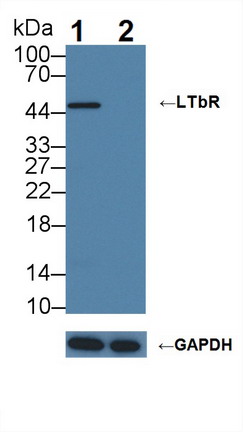 Polyclonal Antibody to Lymphotoxin Beta Receptor (LTbR)