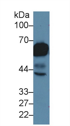 Polyclonal Antibody to Cytokeratin 5 (CK5)